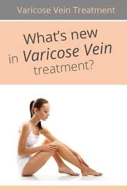 Whats new in varicose vein treatment