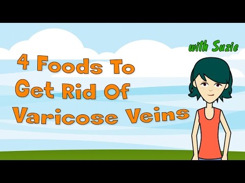Get rid of varicose veins
